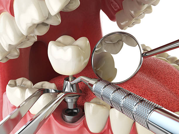 Best Weekend Emergency Dental Services in Holly, MI